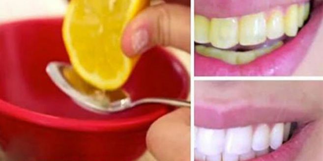 Bahan Sederhana Ini Manjur Putihkan Gigi Dalam 2 Menit