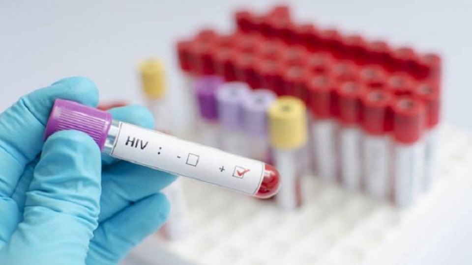 Ilmuwan Ciptakan Teknologi USB Khusus Untuk Tes HIV