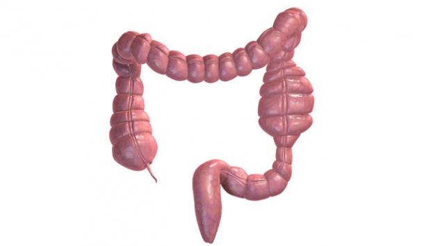  Waspadai Kanker Usus Besar bila Sulit Buang Air Besar 