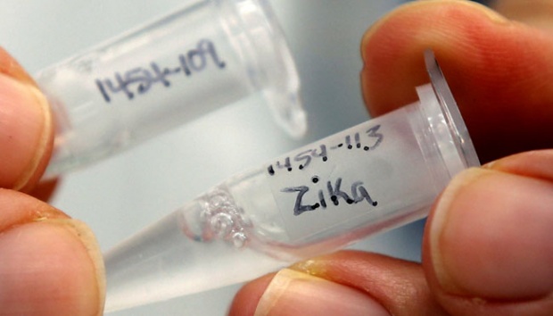  Pakar Temukan Sisi Positif Virus Zika 