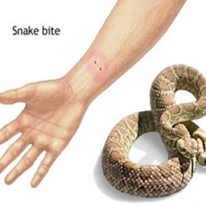 5 Bahan alami untuk pertolongan pertama kala digigit ular