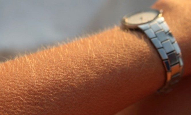 Merinding Waktu Dengar Musik, Indikasi Otak Anda Berbeda! Berikut Penjelasannya