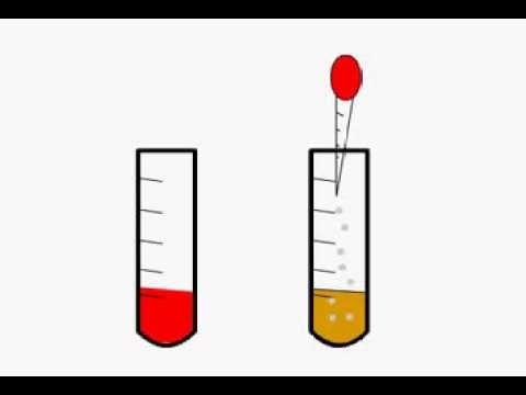 Tidak Rumit, Yuk Pelajari Cara Menentukan pH Suatu Larutan