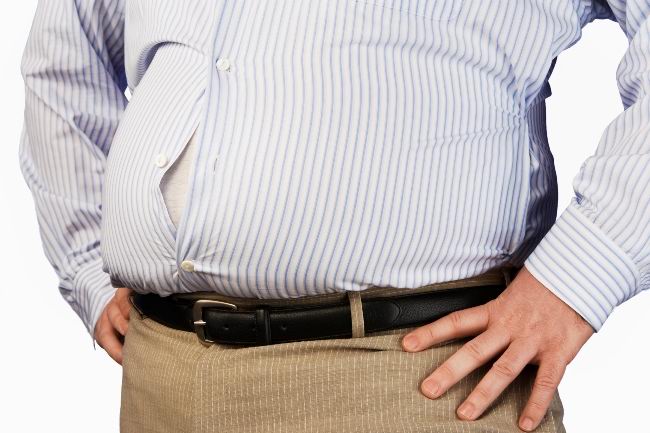 Pengertian Obesitas, Gejala, Penyebab dan Cara Mengobati