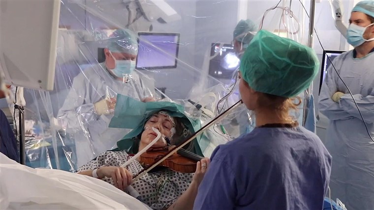 Pemandangan Tak Biasa Sekaligus Menakjubkan, Seorang Pasien Jalani Operasi Otak Sambil Main Biola