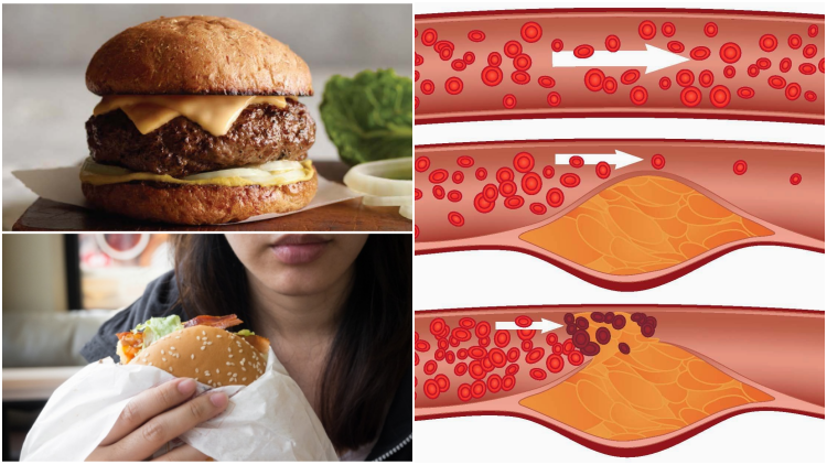 3 Hal yang Terjadi di Dalam Tubuh Setelah Makan Burger, Dimulai Sejak 15 Menit Pertama