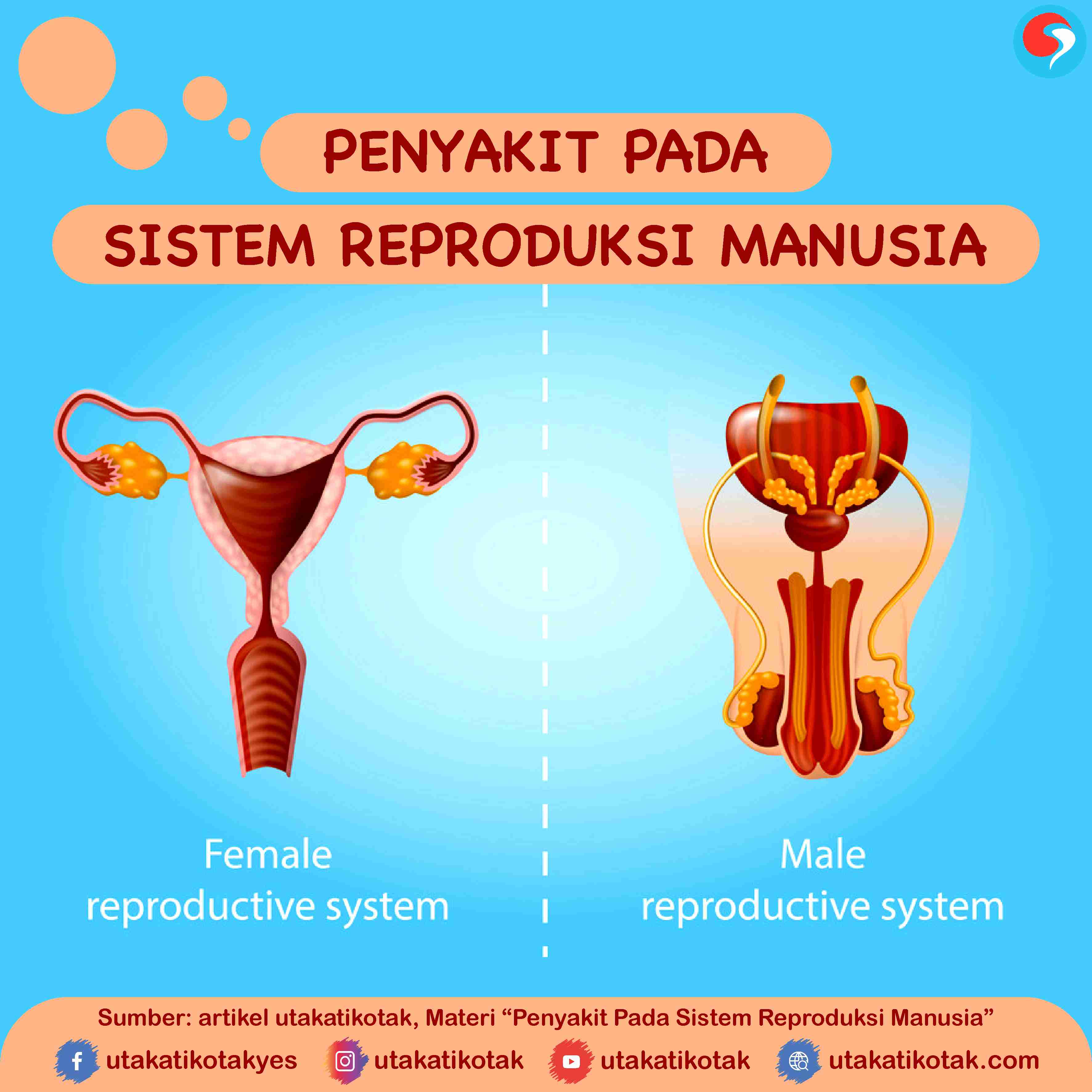 Gangguan yang terjadi pada sistem reproduksi pria yang disebabkan oleh virus herpes adalah