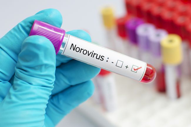 Coronavirus Belum Usai, China Kembali Diguncang dengan Norovirus, Apa itu?