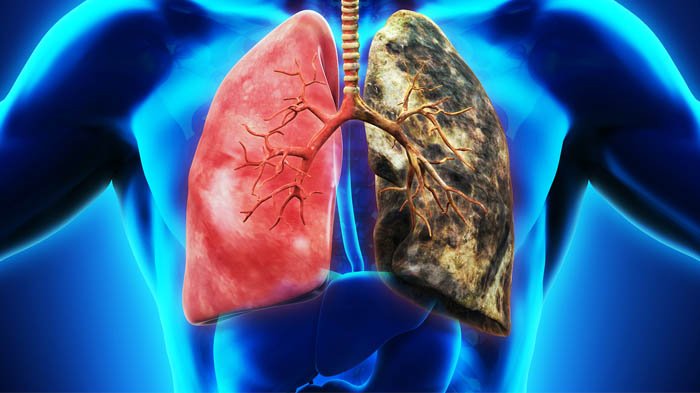 Upaya Untuk Menjaga Kesehatan Paru-paru